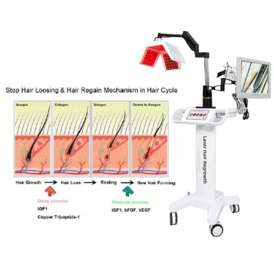 Haarwuchs-Lasermaschine 650 nm zur Behandlung von Haarwuchs und Haarausfall