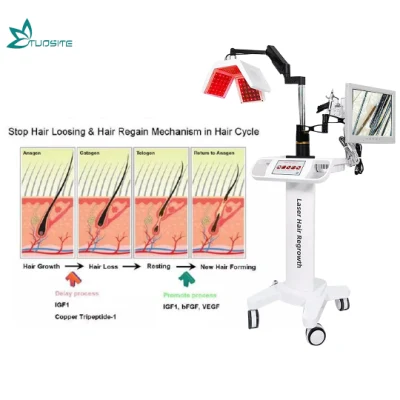 Professionelle Diodenlaser-Haarnachwuchsmaschine zur Behandlung von Haarausfall